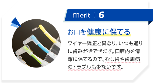 merit6:フロスが使える マウスピースはご自身で取り外しができるので歯磨きもフロスもしっかりでき、衛生的で快適に治療を続けることができます。